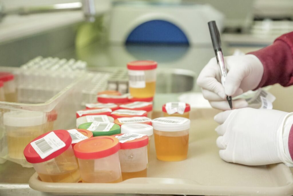 Pesquisas sobre doenças tropicais são ampliadas no estado pelo governo de RO