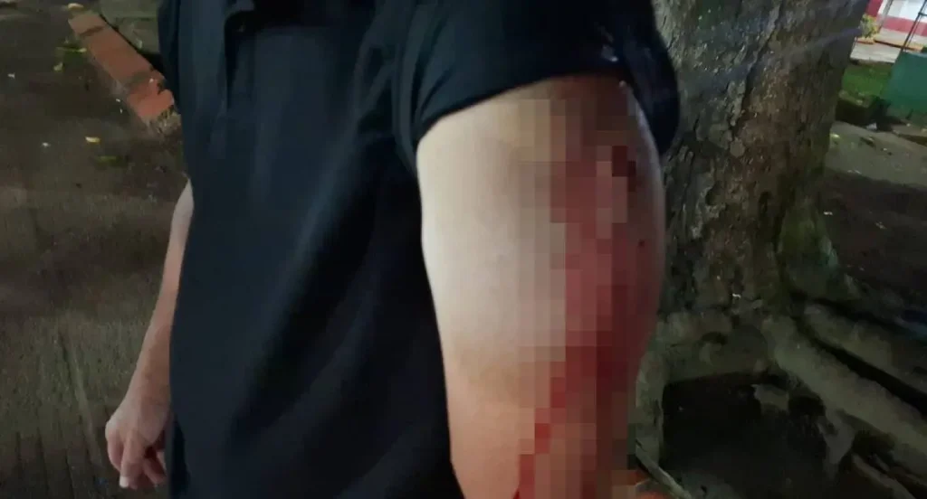 Homem é esfaqueado durante tentativa de roubo no Centro de Porto Velho