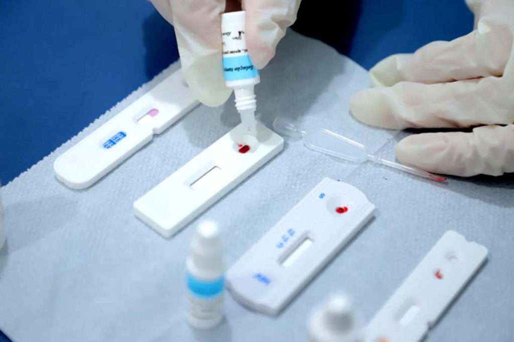 A importância da continuidade: No Julho Amarelo, Rondônia monitora a interrupção do tratamento da Hepatite B na região Madeira-Mamoré